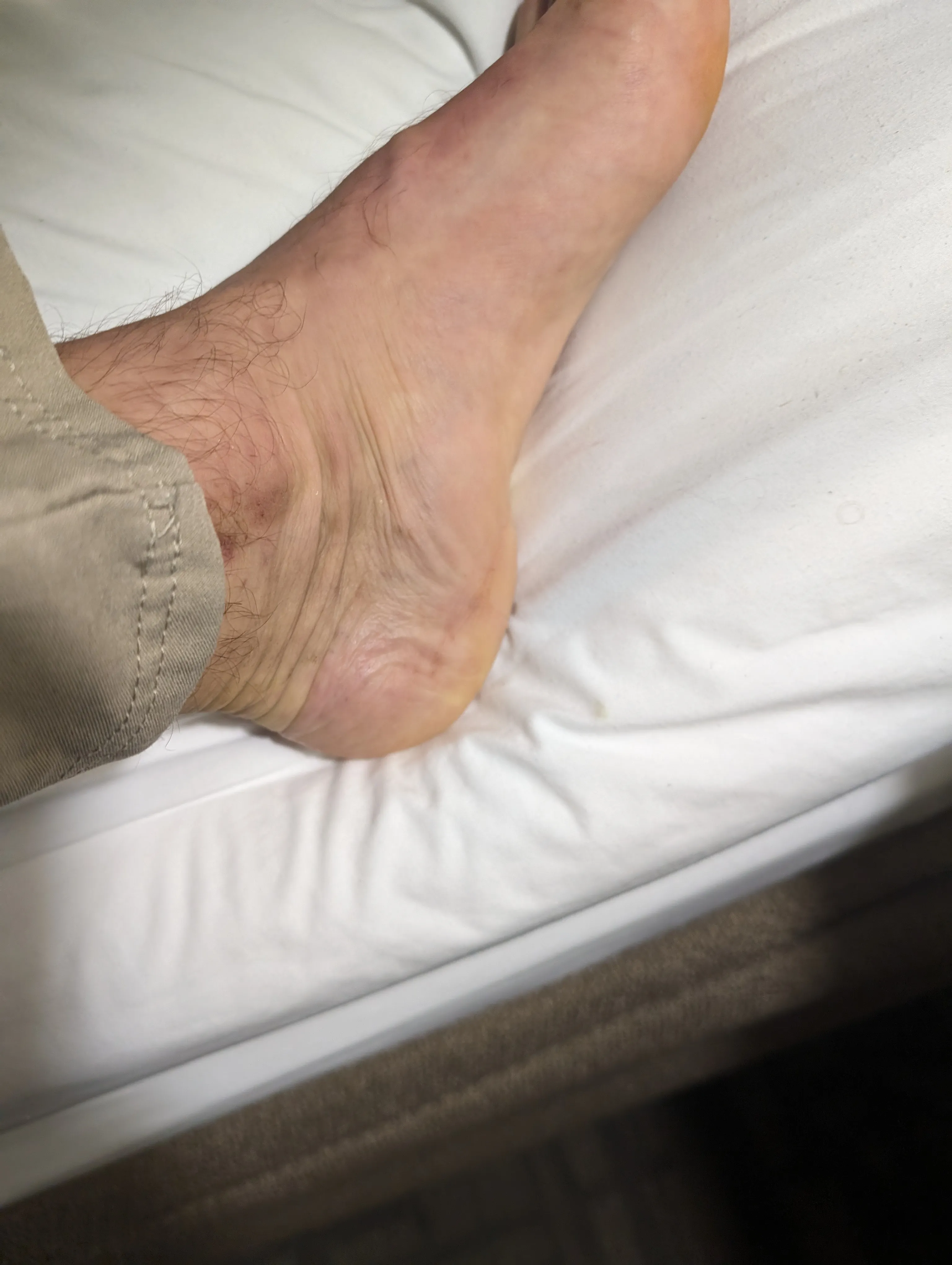 Photo from blog post 187