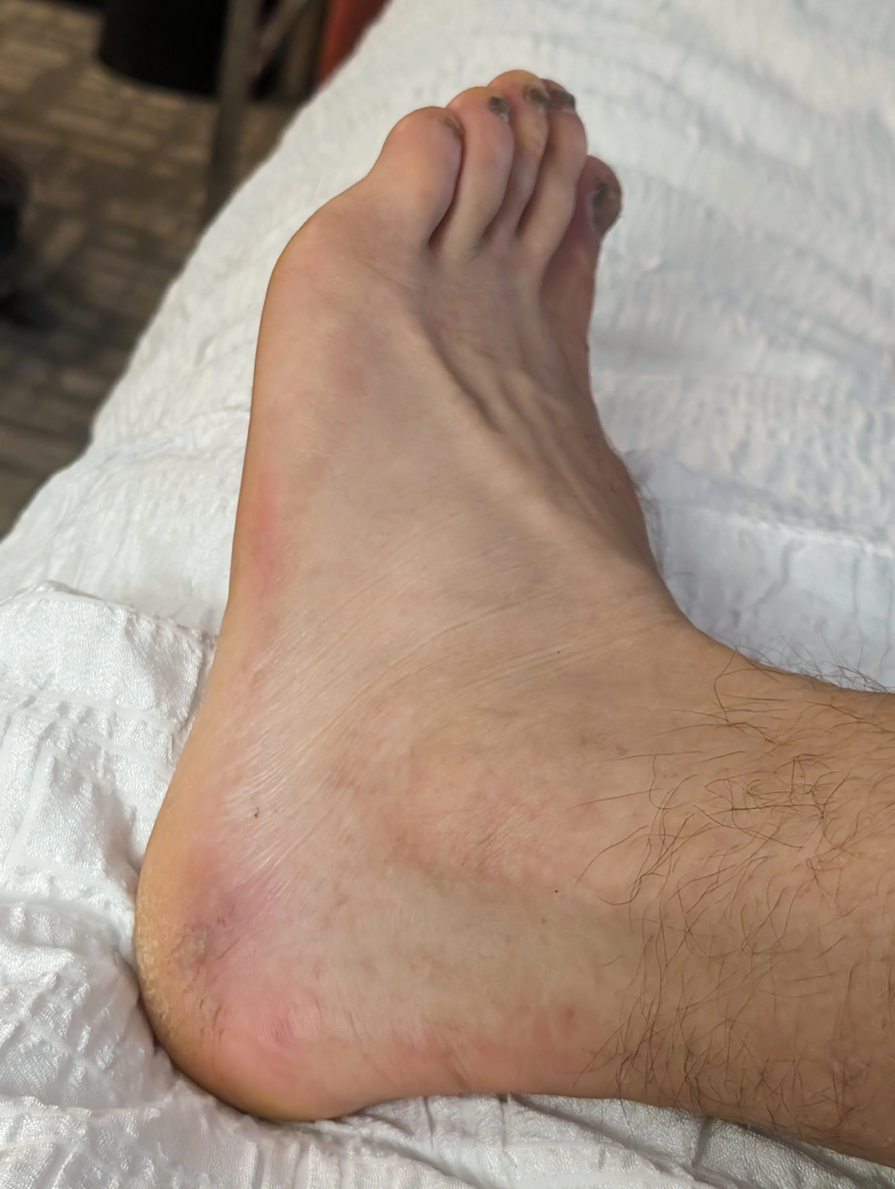 Photo from blog post 187