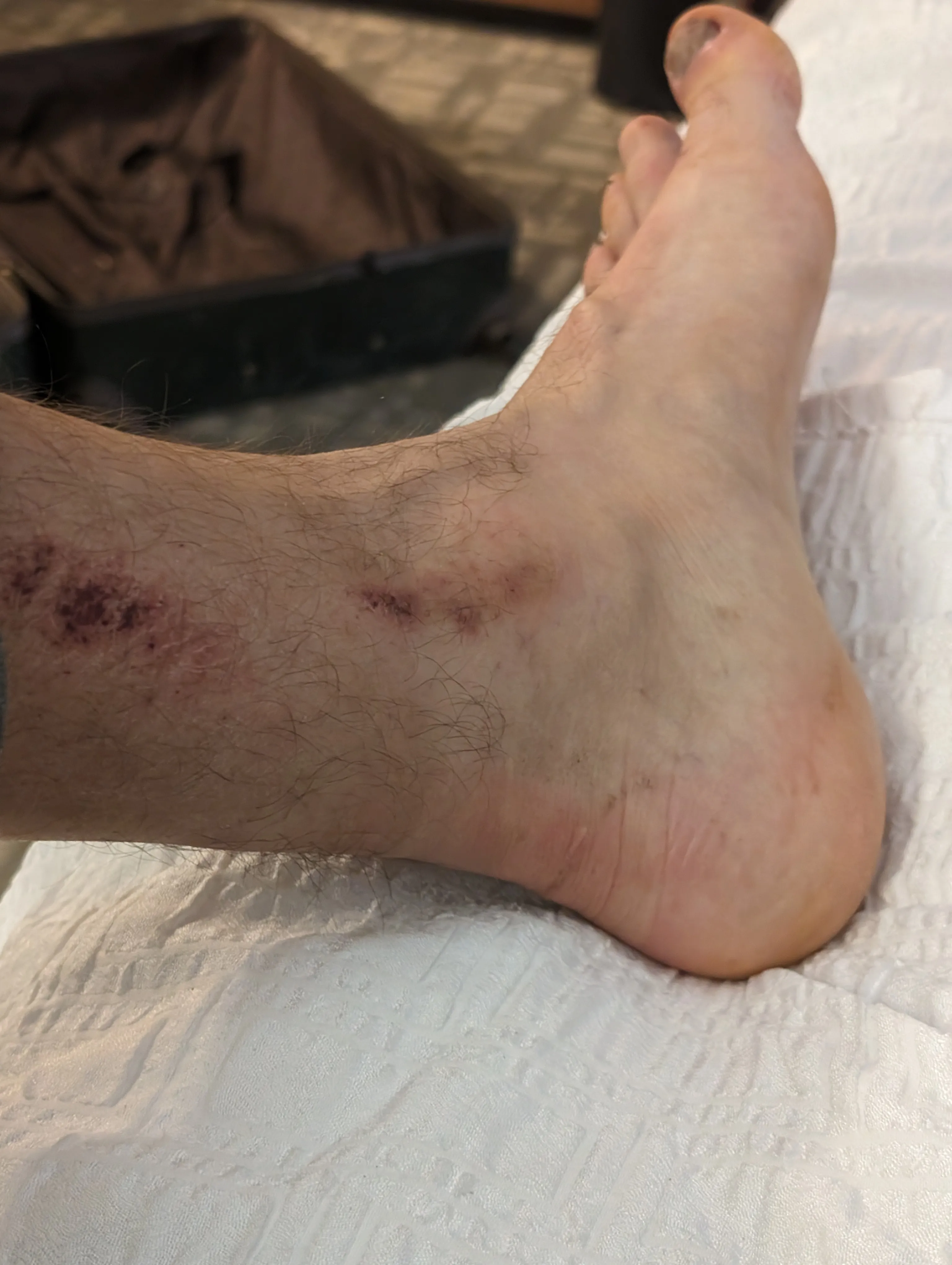 Photo from blog post 187